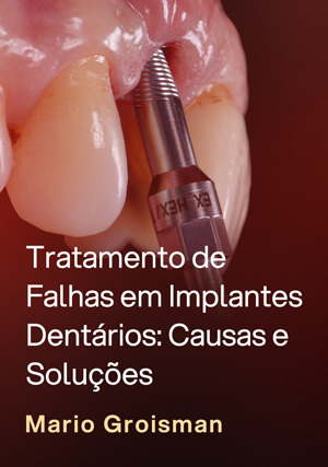 Cover for Tratamento de Falhas em Implantes Dentários: Causas e Soluções