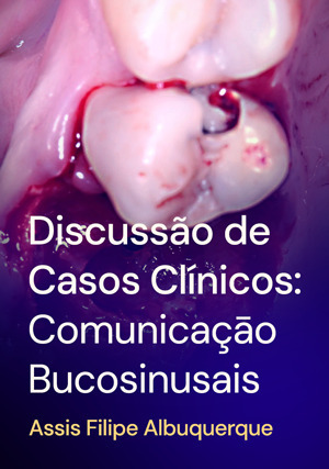Cover for Discussão de Casos Clínicos: Comunicaçāo Bucosinusais