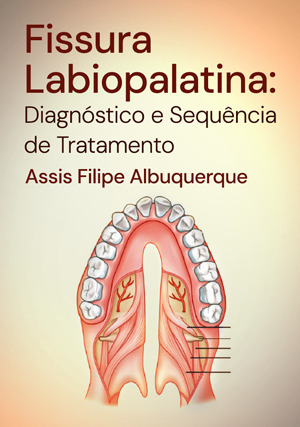 Cover for Fissura Labiopalatina: Diagnóstico e Sequência de Tratamento