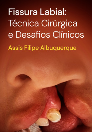 Cover for Fissura Labial: Técnica Cirúrgica e Desafios Clínicos
