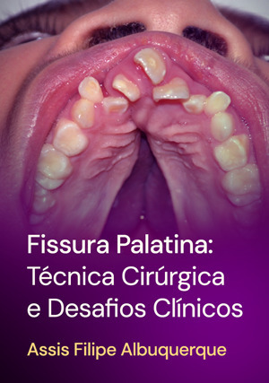 Cover for Fissura Palatina: Técnica Cirúrgica e Desafios Clínicos