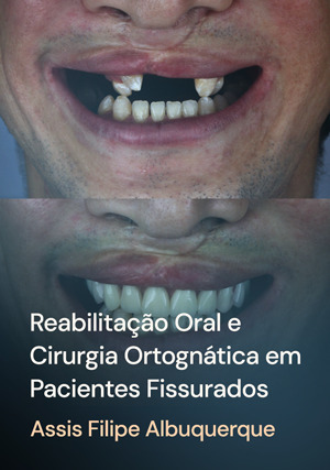 Cover for Reabilitação Oral e Cirurgia Ortognática em Pacientes Fissurados