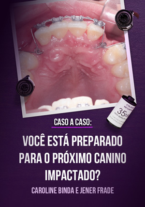 Cover for Caso a Caso: Você Está Preparado para o Próximo Canino Impactado?