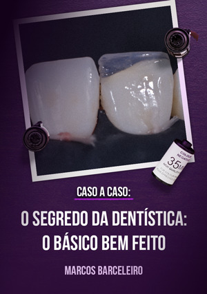 Cover for Ao Vivo: Caso a Caso - O Segredo da Dentística: O Básico Bem Feito