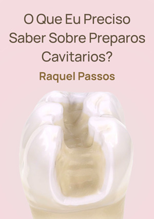 Cover for O Que Eu Preciso Saber Sobre Preparos Cavitarios?