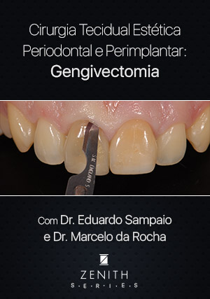 Cover for Cirurgia Tecidual Estética Periodontal e Peri-implantar: Gengivectomia