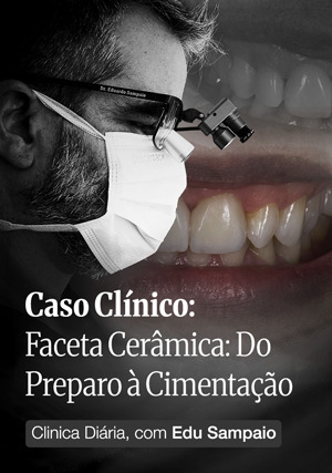 Cover for Caso Clínico - Faceta Cerâmica: do preparo à cimentação