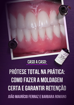 Cover for Prótese Total na Prática: Como Fazer a Moldagem Certa e Garantir Retenção