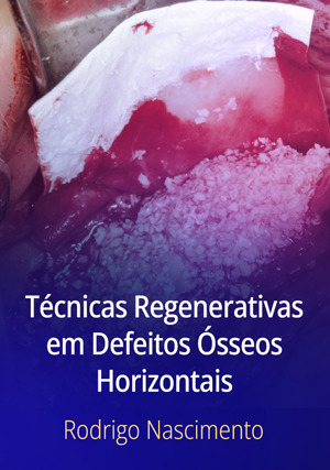 Cover for Técnicas Regenerativas em Defeitos Ósseos Horizontais