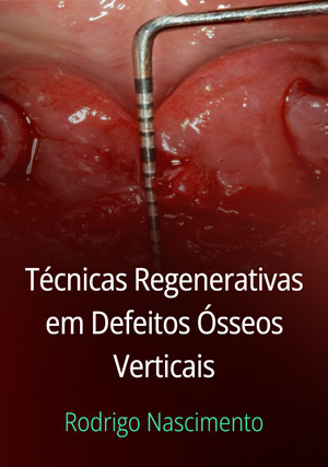 Cover for Técnicas Regenerativas em Defeitos Ósseos Verticais