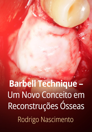 Cover for Barbell Technique – Um Novo Conceito em Reconstruções Ósseas