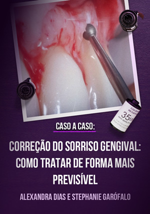 Cover for Caso a Caso -Correção do Sorriso Gengival: como tratar de forma mais previsível