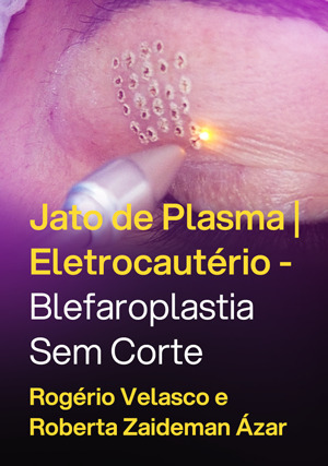 Cover for Jato de Plasma | Eletrocautério - Blefaroplastia sem corte