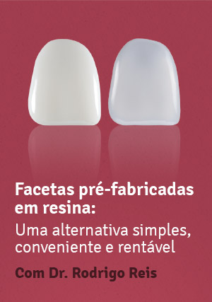Cover for Facetas pré-fabricadas em resina: uma alternativa simples, conveniente e rentável