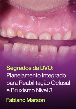 Cover for Segredos da DVO: Planejamento Integrado para Reabilitação Oclusal e Bruxismo nível 3