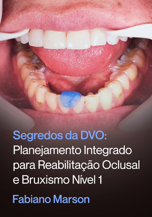 Cover for Segredos da DVO: Planejamento Integrado para Reabilitação Oclusal e Bruxismo nível 1