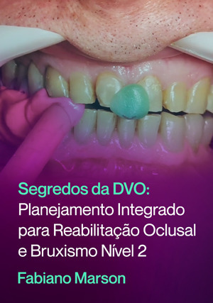Cover for Segredos da DVO: Planejamento Integrado para Reabilitação Oclusal e Bruxismo nível 2