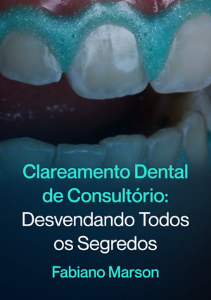 Cover for Clareamento Dental de Consultório: Desvendando Todos os Segredos