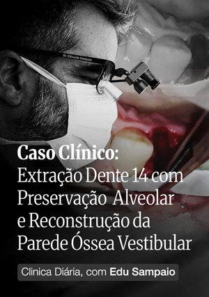 Cover for Caso Clínico: Extração Dente 14 com Preservação  Alveolar e Reconstrução da Parede Óssea Vestibular