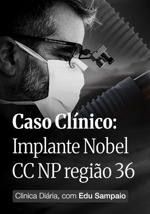 Cover for Caso Clínico: Implante Nobel CC NP região 36