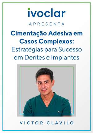 Cover for Ivoclar Apresenta: Cimentação Adesiva em Casos Complexos: Estratégias para Sucesso em Dentes e Implantes