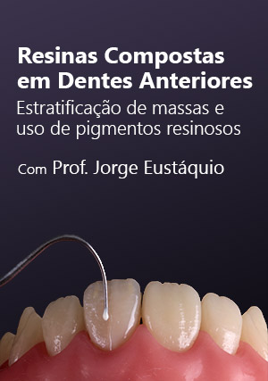 Cover for Resinas Compostas para Dentes Anteriores: Estratificação de Massas e Uso de Pigmentos Resinosos