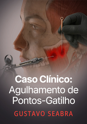 Cover for Caso Clínico: Agulhamento de Pontos-Gatilho