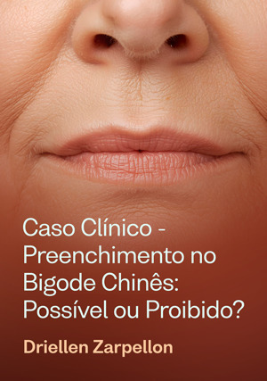 Cover for Caso Clínico - Preenchimento no Bigode Chinês: possível ou proibido?
