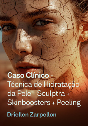 Cover for Caso Clínico: ⁠Técnica de Hidratação da Pele - Sculptra + Skinboosters + Peeling