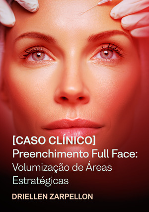Cover for Caso Clínico - Preenchimento Full Face: volumização de áreas estratégicas