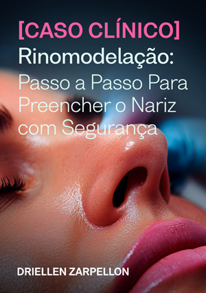 Cover for Rinomodelação: passo a passo para preencher o nariz com segurança