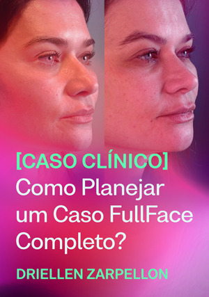 Cover for Caso Clínico: Como planejar um caso FullFace completo?