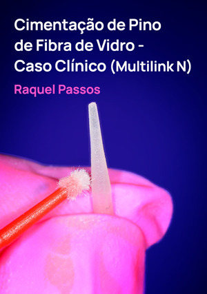 Cover for Cimentação de Pino de Fibra de Vidro - Caso Clínico (Multilink N)
