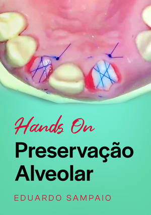 Cover for Hands on: Preservação Alveolar