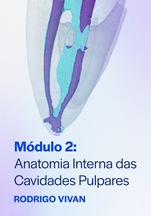 Cover for Módulo 2: Anatomia Interna das Cavidades Pulpares