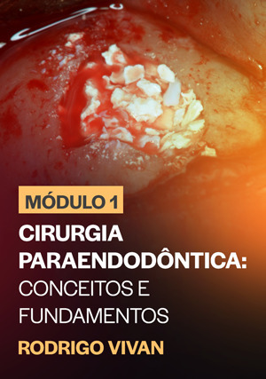 Cover for Módulo 1: Cirurgia Paraendodôntica: Conceitos e Fundamentos