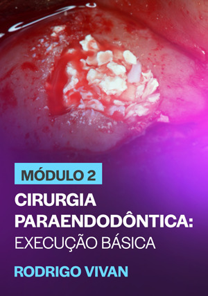 Cover for Módulo 2: Cirurgia Paraendodôntica: Execução Básica