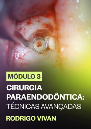 Cover for Módulo 3: Cirurgia Paraendodôntica: Técnicas avançadas