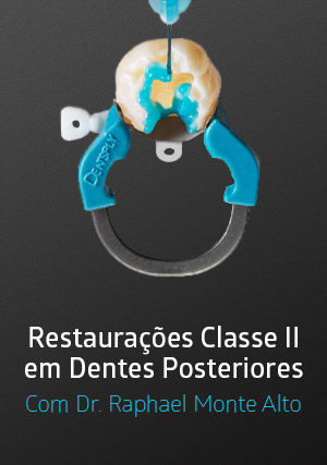 Cover for Restaurações Classe II em Dentes Posteriores