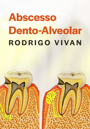 Cover for Abscesso dento-alveolar