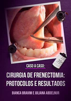 Cover for Caso a Caso: Cirurgia de Frenectomia: Protocolos e Resultados