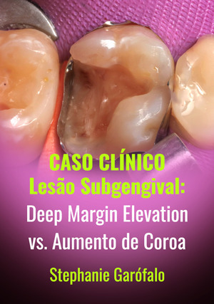 Cover for Caso Clínico: Lesão Subgengival: Deep Margin Elevation vs. Aumento de Coroa