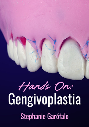 Cover for Hands on: Gengivoplastia