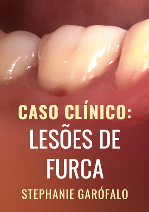 Cover for Caso Clínico: Lesões de Furca
