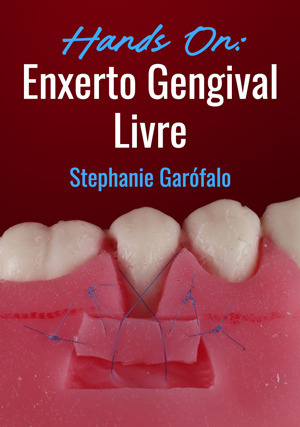 Cover for Hands on: Enxerto Gengival Livre