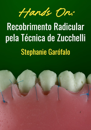 Cover for Hands on: Recobrimento Radicular pela Técnica de Zucchelli