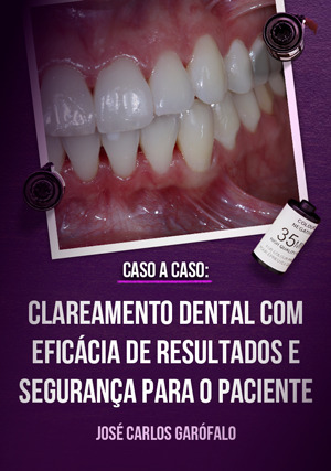 Cover for Caso a Caso: Clareamento Dental com Eficácia de Resultados e Segurança para o Paciente