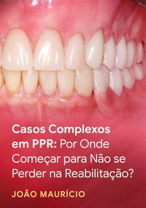 Cover for Casos Complexos em PPR: Por Onde Começar para Não se Perder na Reabilitação?