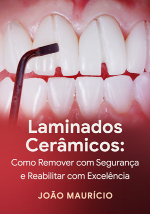 Cover for Laminados Cerâmicos: como remover com segurança e reabilitar com excelência