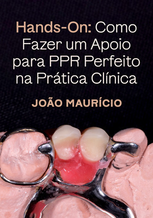 Cover for Hands-on: Como Fazer um Apoio para PPR Perfeito na Prática Clínica